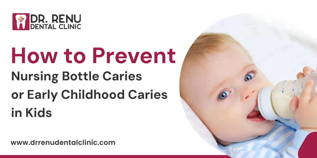 How to Prevent Nursing Bottle Caries or Early Childhood Caries in Kids
