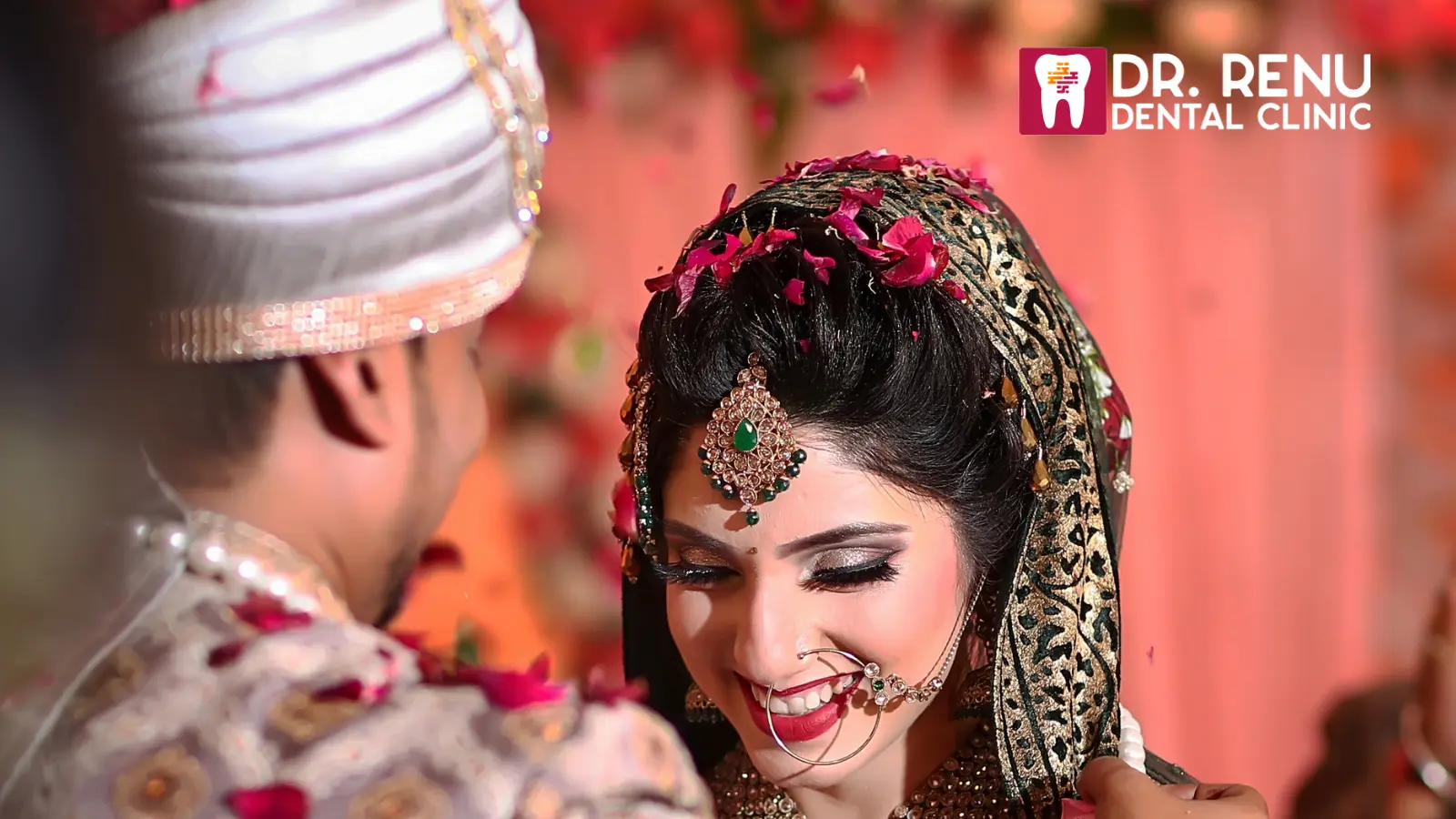 शादी के दिन की सबसे अच्छी मुस्कान कैसे प्राप्त करें – जिस मुस्कान का आपने सपना देखा है?