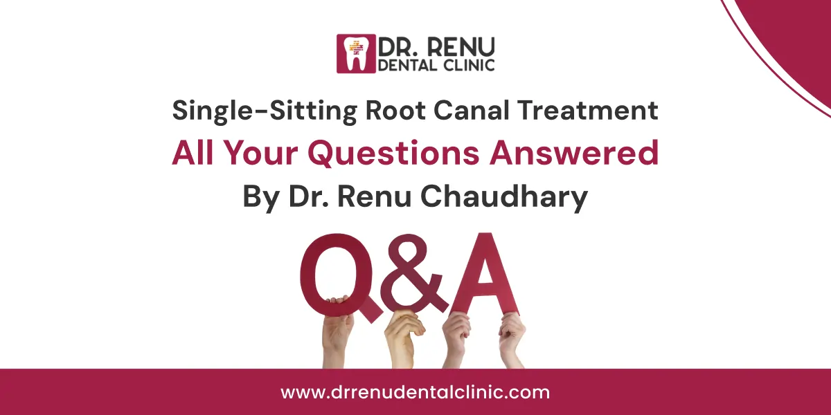 Single-Sitting Root Canal Treatment: All Your Questions Answered By Dr. Renu Chaudhary