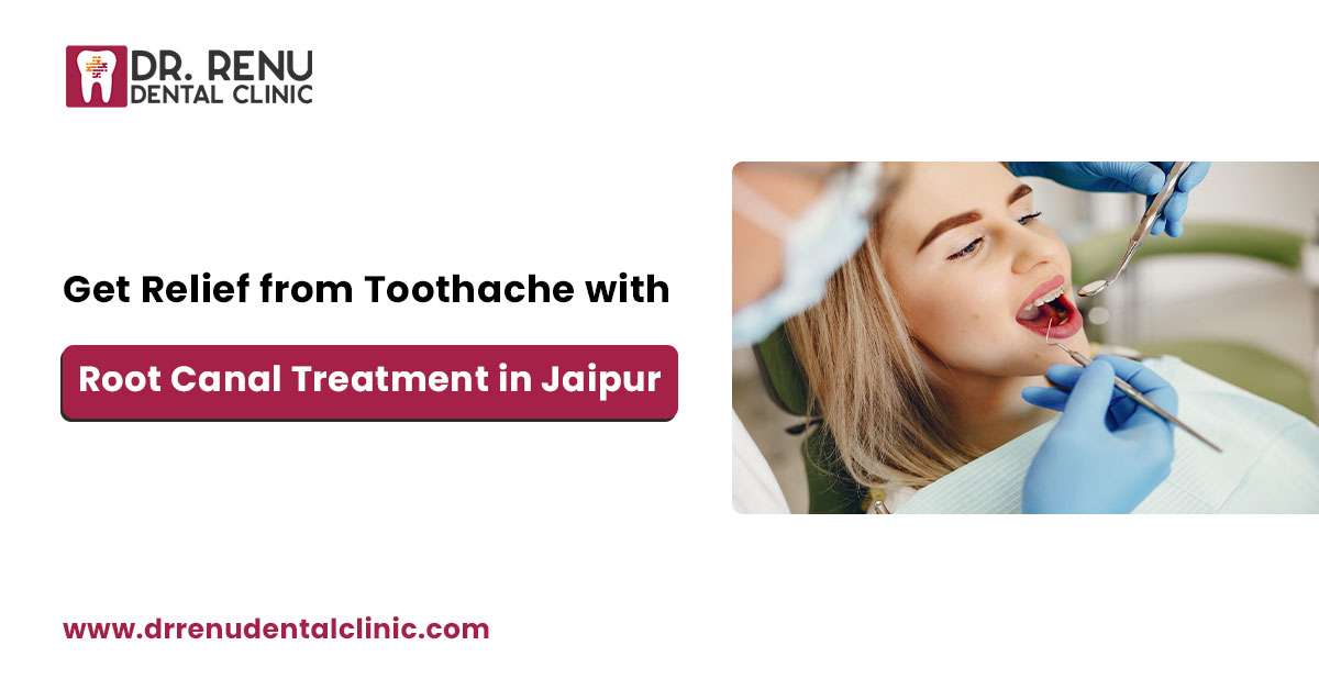 Relief from Toothache with Root Canal Treatment by Dr. Renu Chaudhary
