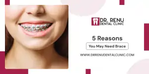5 Reasons You May Need Braces