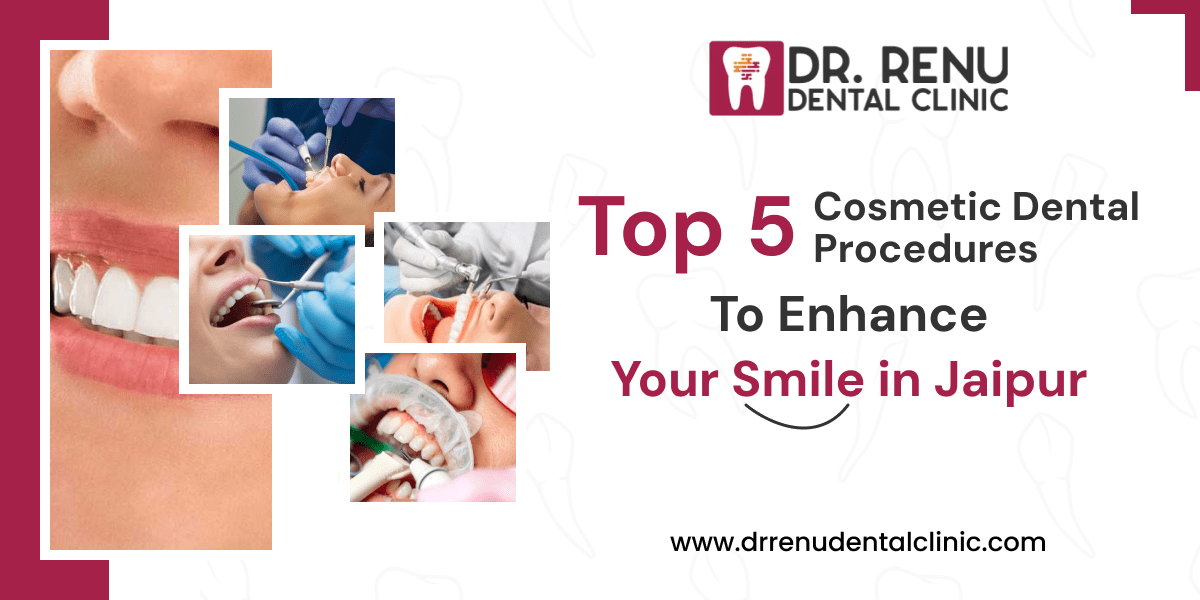 Top 5 Cosmetic Dental Procedures to Enhance Your Smile in Jaipur