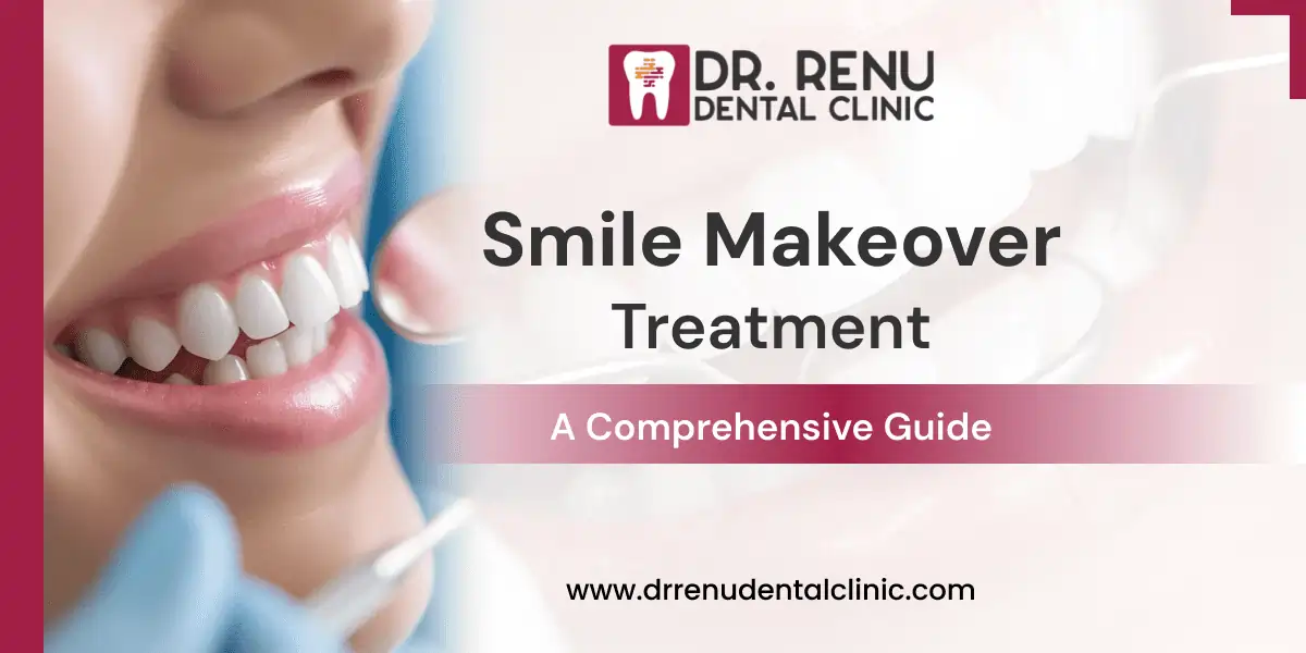 Smile Makeover Treatment by Dr. Renu Chaudhary – A Comprehensive Guide