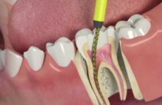 Dentist in Malviya Nagar