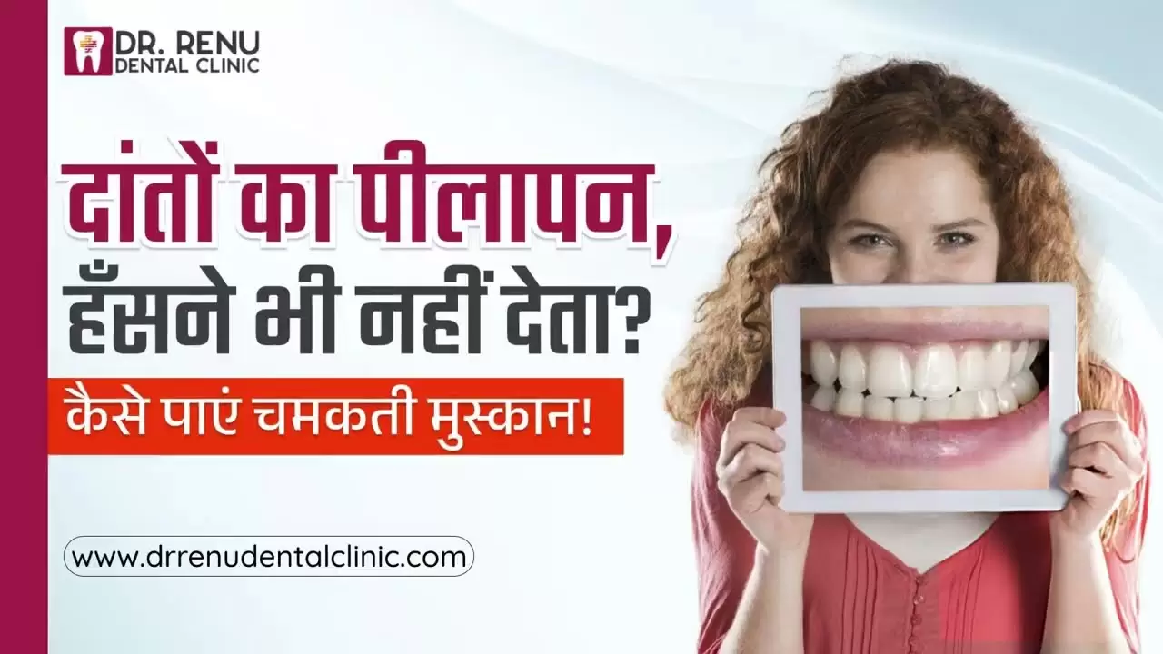 Dr. Renu Dental Health Tips