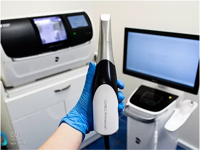 CEREC Sirona – Chairside Restorations