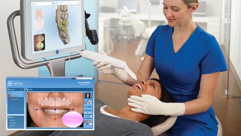 Digital Smile Design (DSD) Software