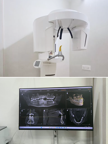 whychoose CBCT