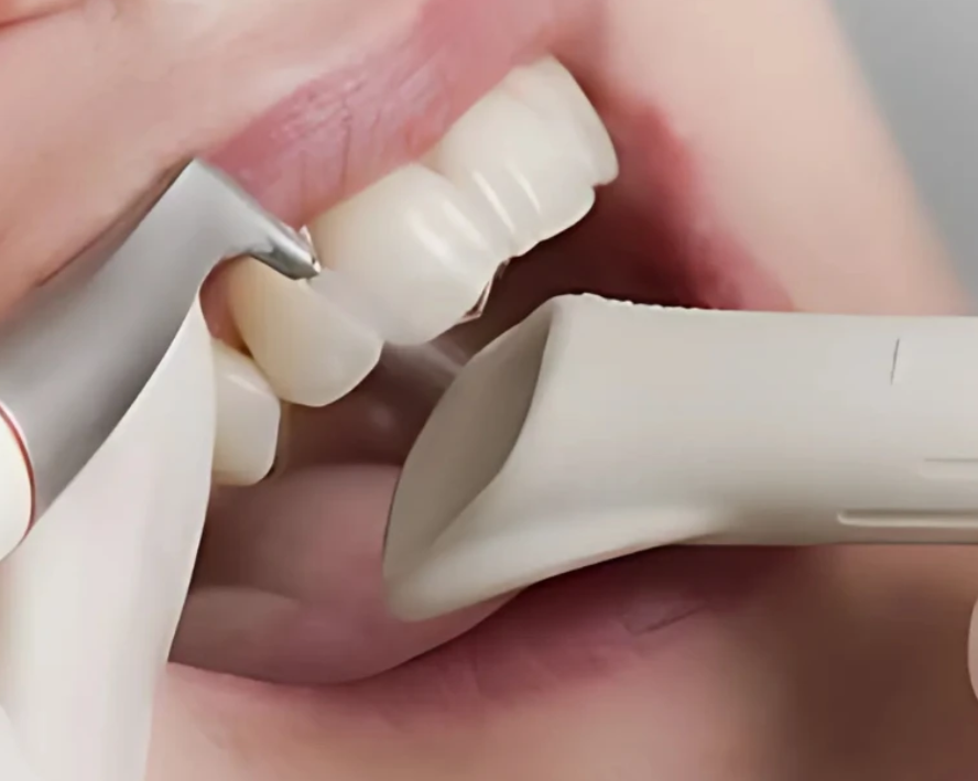 Painless Teeth Cleaning