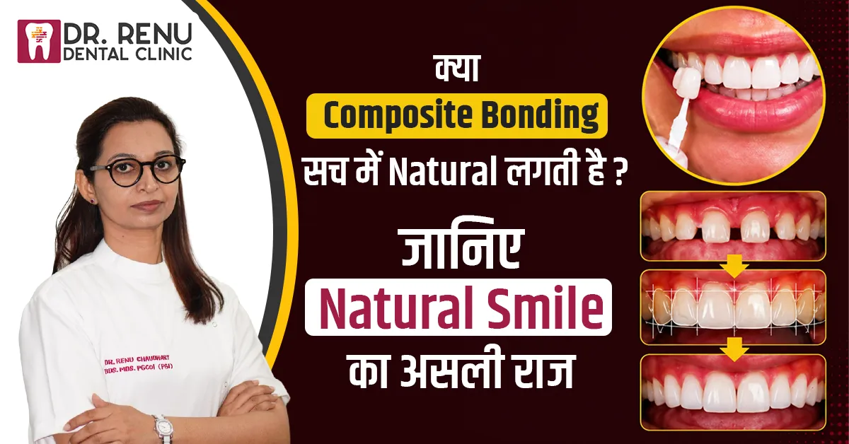 क्या Composite Bonding सच में Natural लगती है?