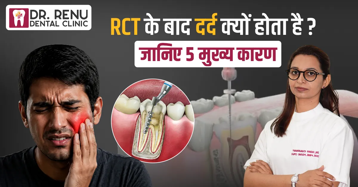 RCT के बाद दर्द क्यों होता है? जानिए 5 मुख्य कारण और सही इलाज