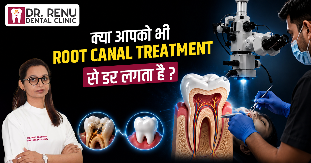 क्या आपको भी Root Canal Treatment से डर लगता है?