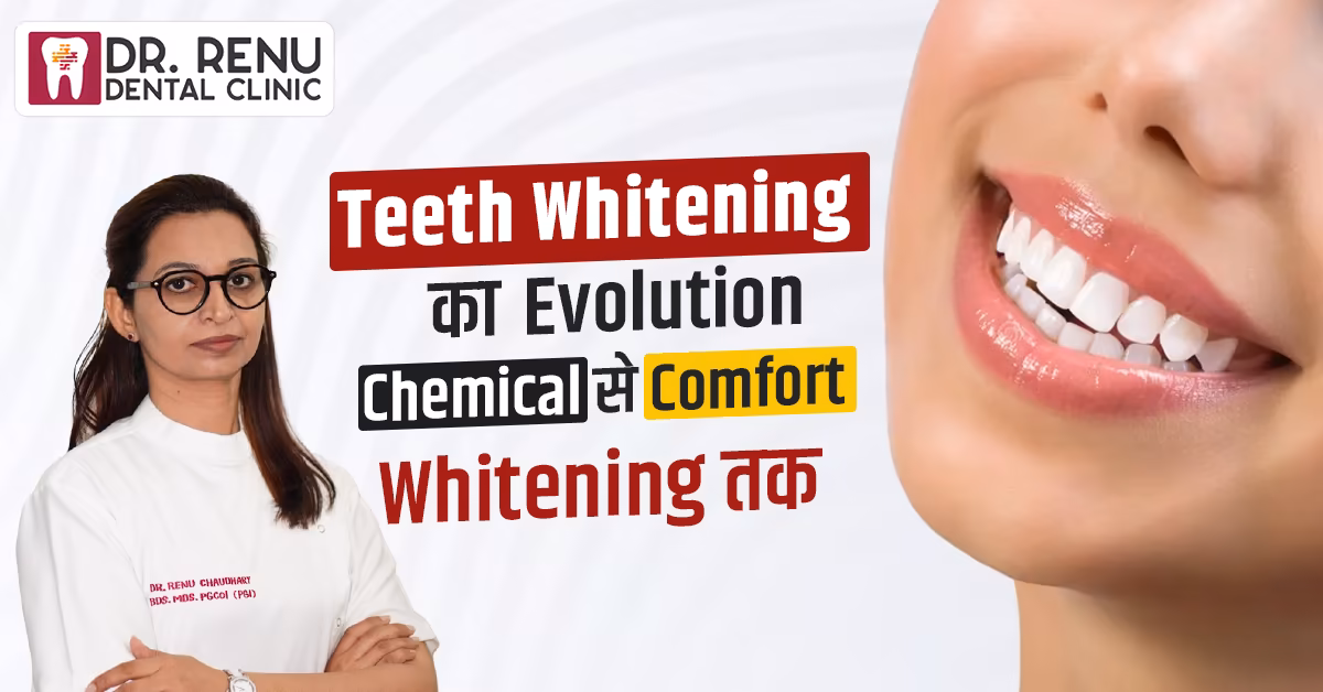 Teeth Whitening का Evolution – Chemical से Comfort Whitening तक