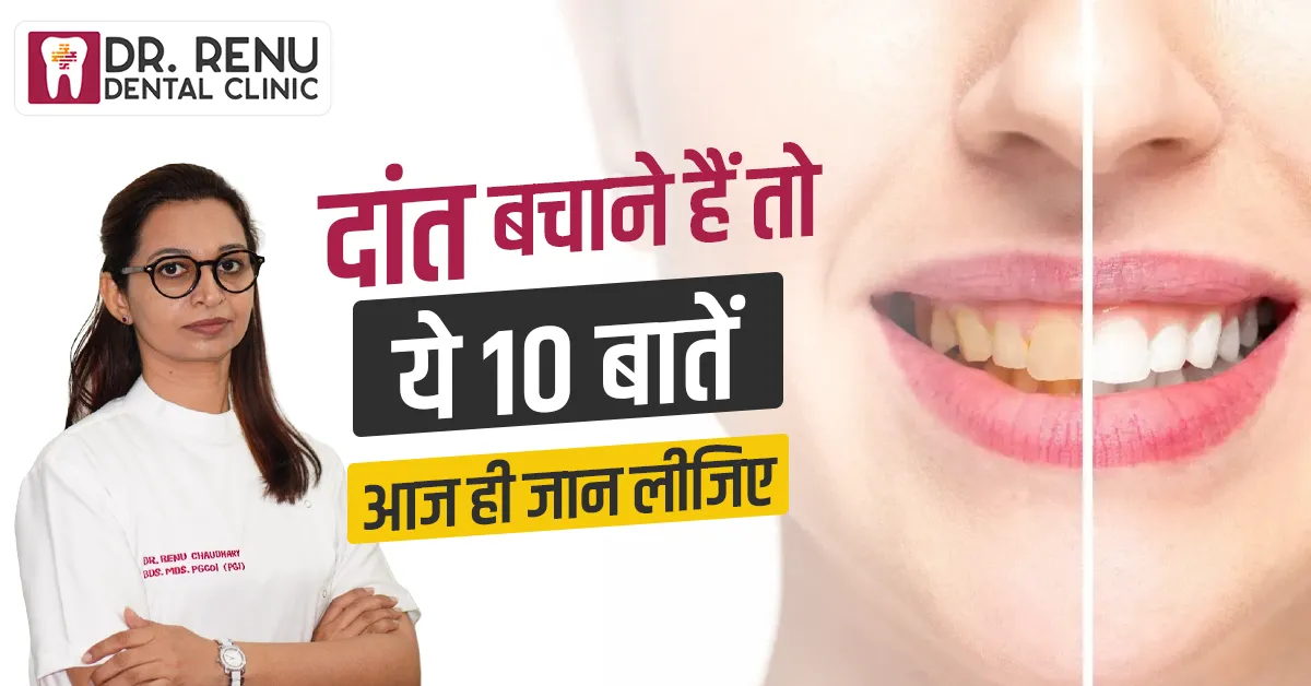 दांत बचाने हैं तो ये 10 बातें आज ही जान लीजिए