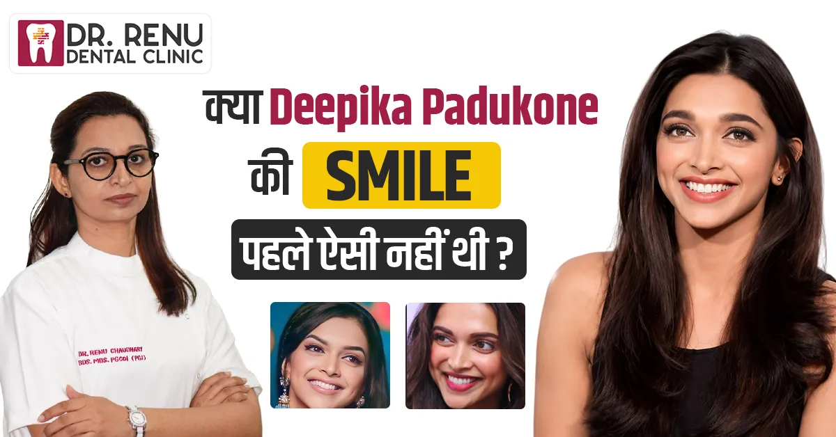 क्या Deepika Padukone की Smile पहले ऐसी नहीं थी?