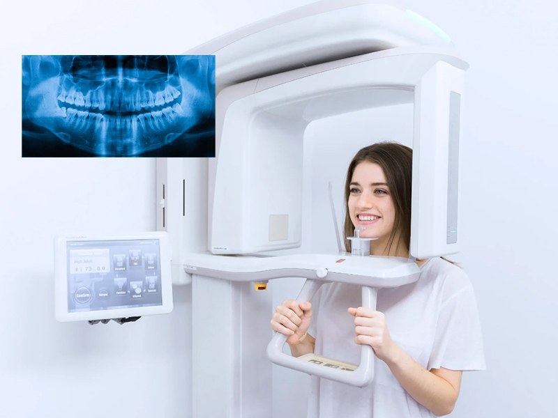 Digital X-ray & OPG