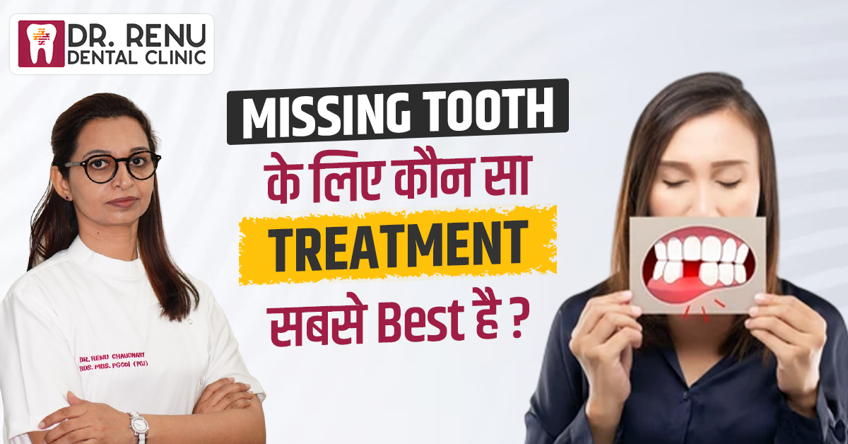 Missing Tooth के लिए कौन सा Treatment सबसे Best है?