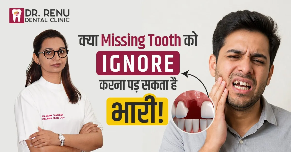 क्या Missing Tooth को Ignore करना पड़ सकता है भारी!