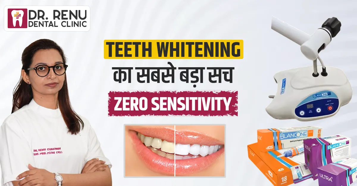 Teeth Whitening का सबसे बड़ा सच: क्या Blank One सच में Zero Sensitivity देता है?