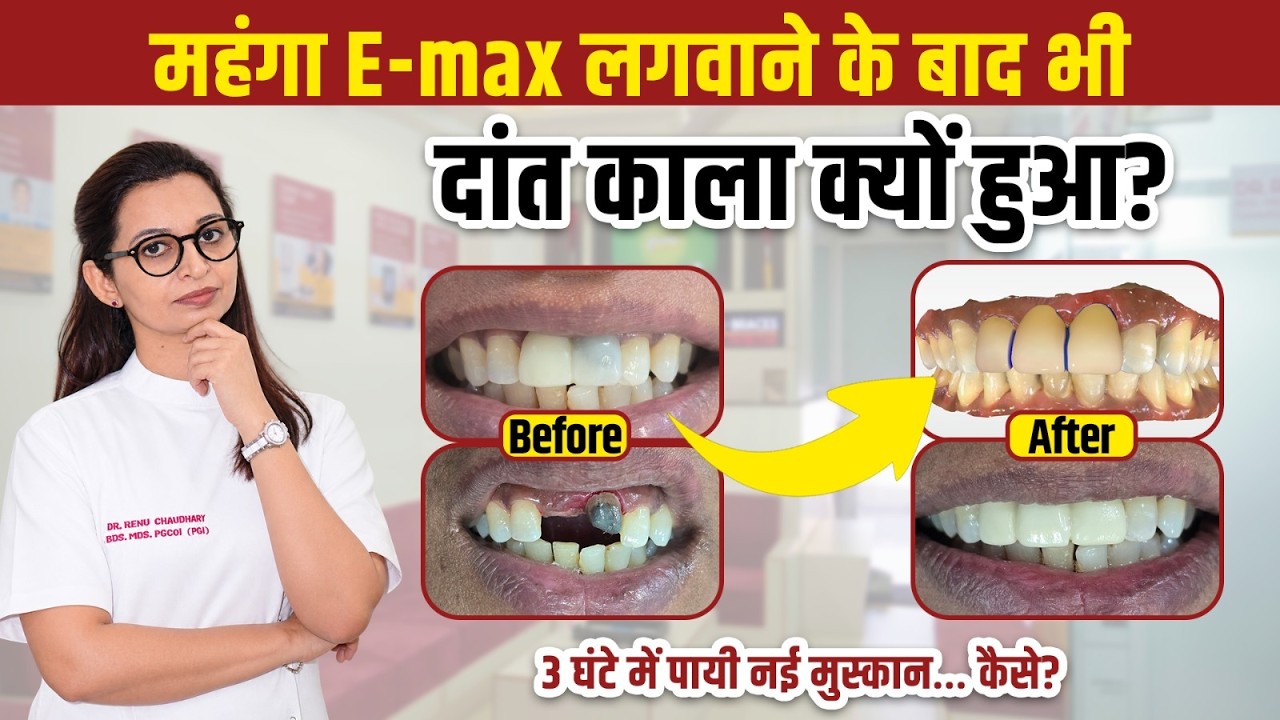 Dr. Renu Dental Health Tips