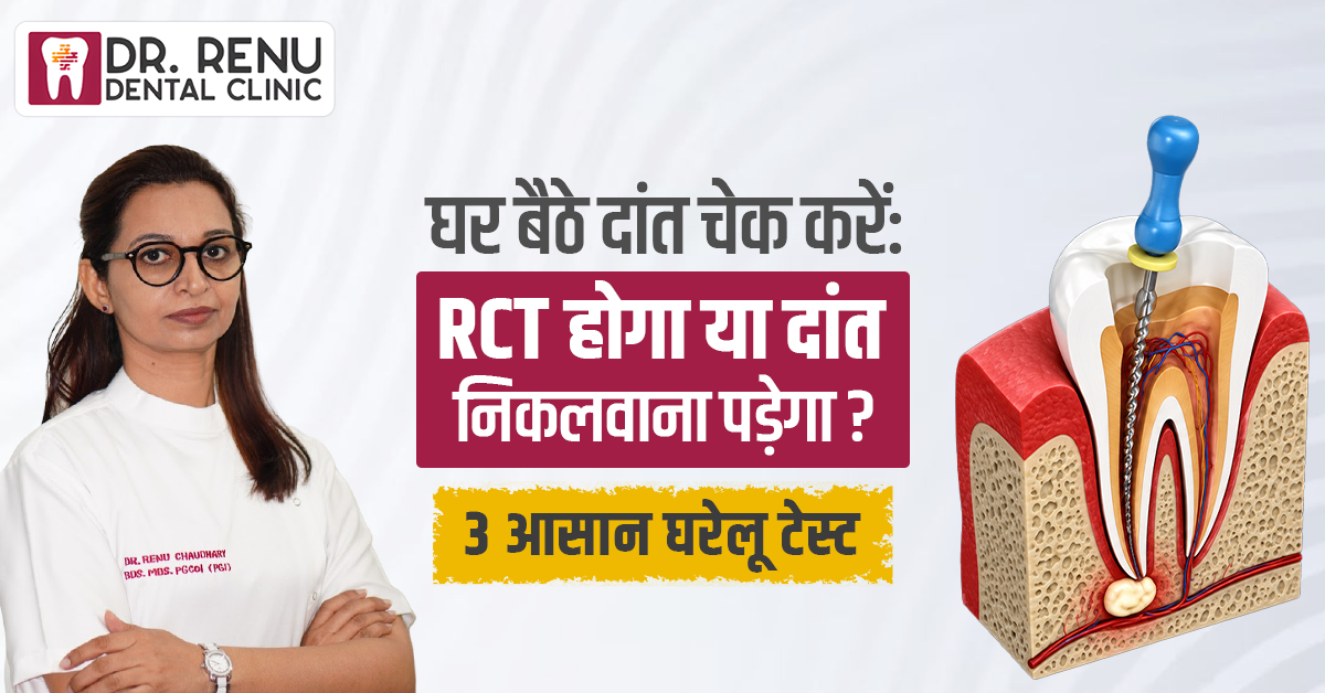 घर बैठे दांत check करें: RCT होगा या दांत निकलवाना पड़ेगा? 3 आसान Home Tests