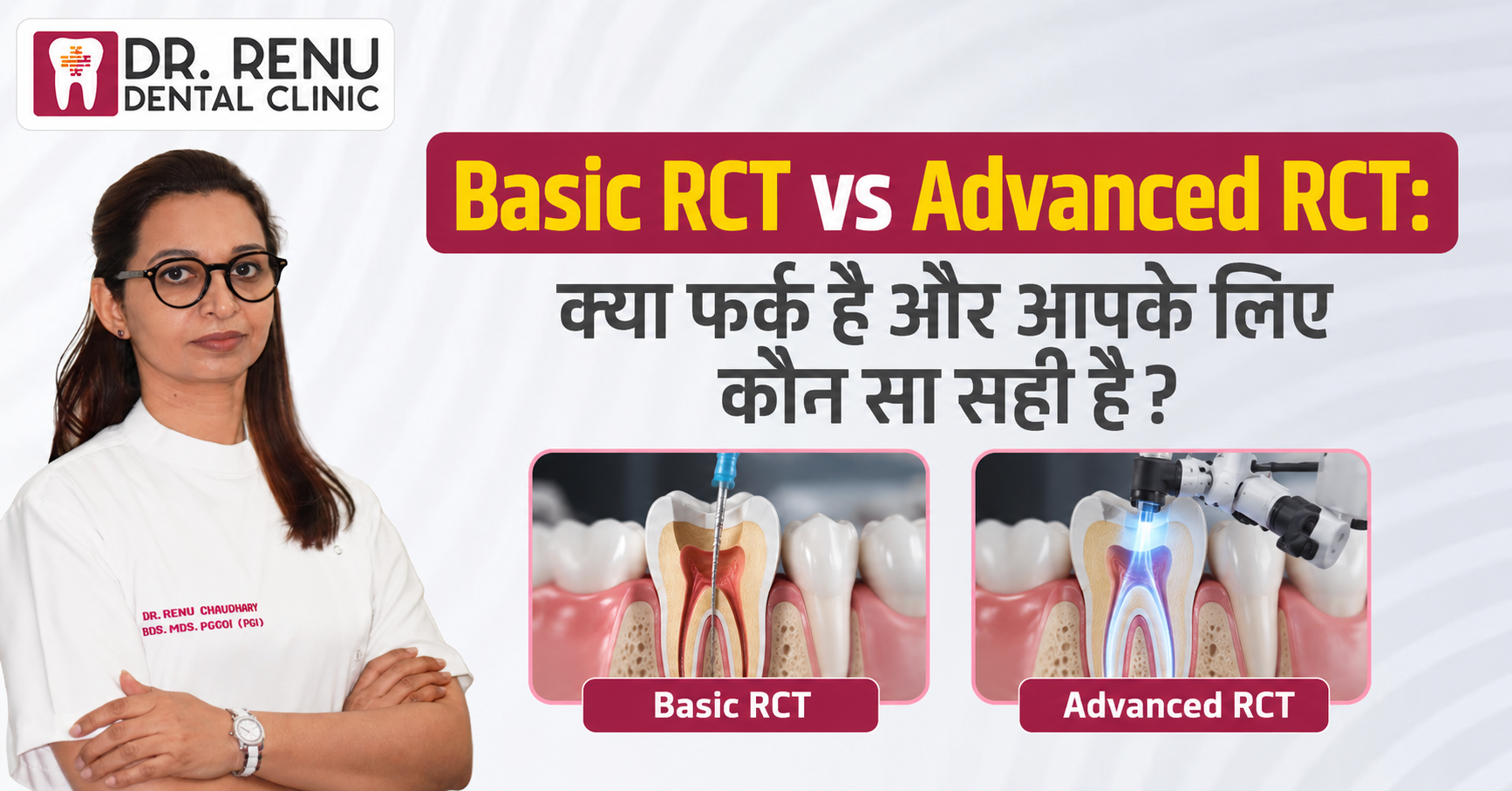 Basic RCT vs Advanced RCT: क्या फर्क है और आपके लिए कौन सा सही है?