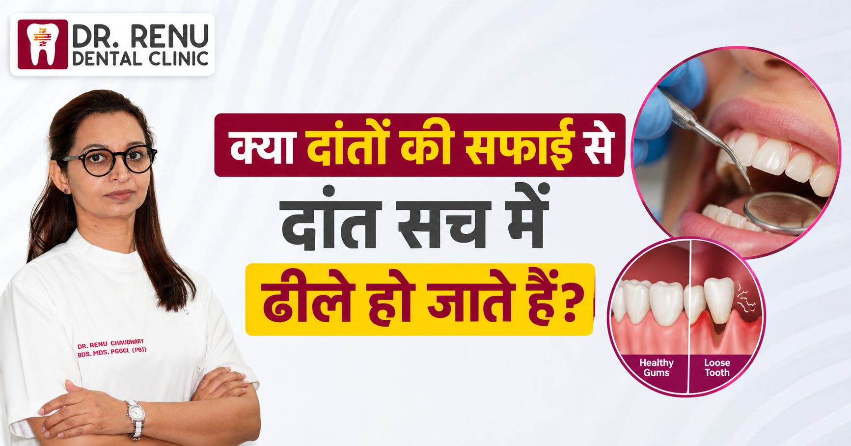 क्या दांतों की सफाई से दांत सच में ढीले हो जाते हैं?